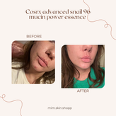 اسنس حلزون کوزارکس