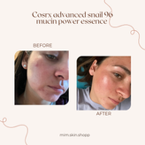 اسنس حلزون کوزارکس
