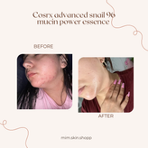 اسنس حلزون کوزارکس