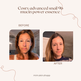اسنس حلزون کوزارکس