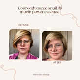 اسنس حلزون کوزارکس