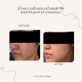 اسنس حلزون کوزارکس