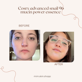 اسنس حلزون کوزارکس